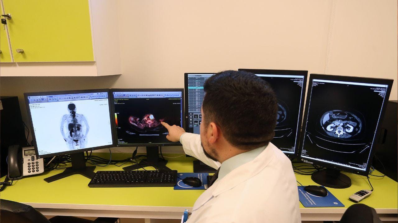 Dr. Melkonian por aumento de cáncer de colon: “Los factores de riesgo son el consumo en exceso de carnes rojas, alcohol y tabaco”