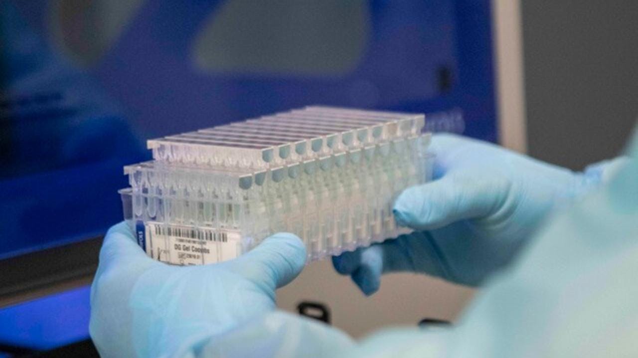 Investigadora U. Andes por test sanguíneo para detectar deterioro cognitivo: “Es como sacarle una foto al cerebro tomando una muestra de sangre