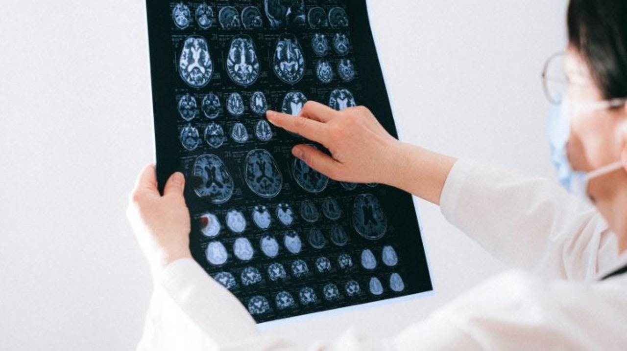 Neurólogo UC CHRISTUS por accidentes cerebrovasculares: “Es la mayor emergencia médica después del paro cardiaco
