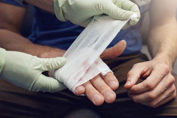 Académica U. de Chile por parche bioactivo: “Las ventajas que proporciona este material es que se pueda liberar rápidamente el agente antibacteriano”