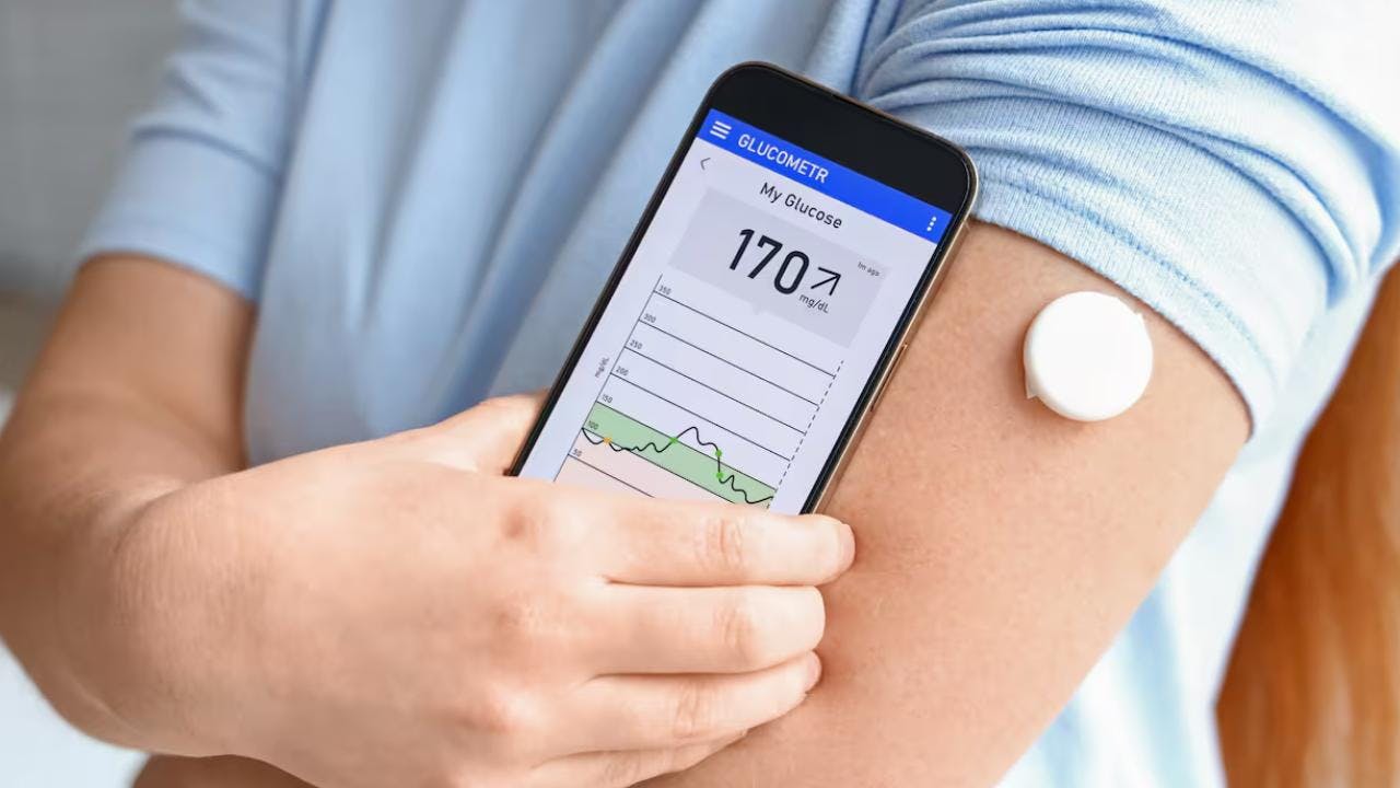 Más allá de un diagnóstico: ¿Cómo funciona el Monitoreo Continuo de Glucosa?