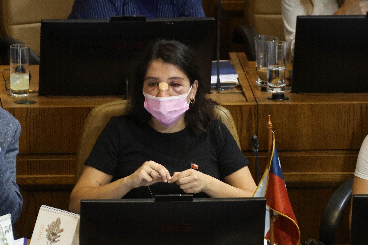 Dan a conocer video de cómo la diputada Veloso sale persiguiendo a ladrones dos horas después de sufrir robo