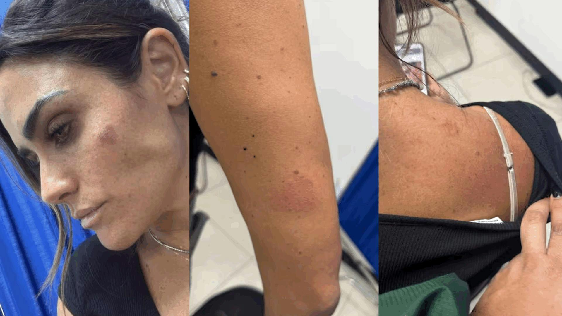 Alessandra Rojo de la Vega denuncia agresiones durante operativo en la San Rafael: "Fui derribada de mi moto"