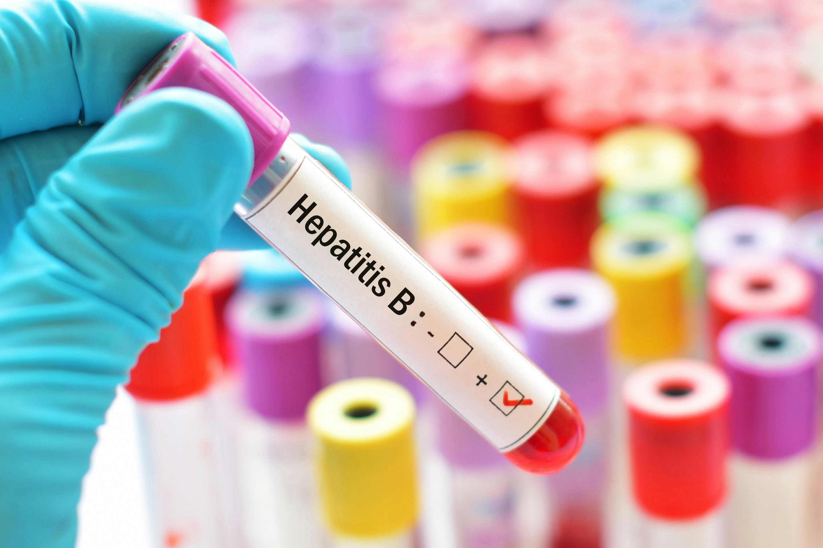 Fármaco experimental logra “cura funcional” contra la hepatitis B