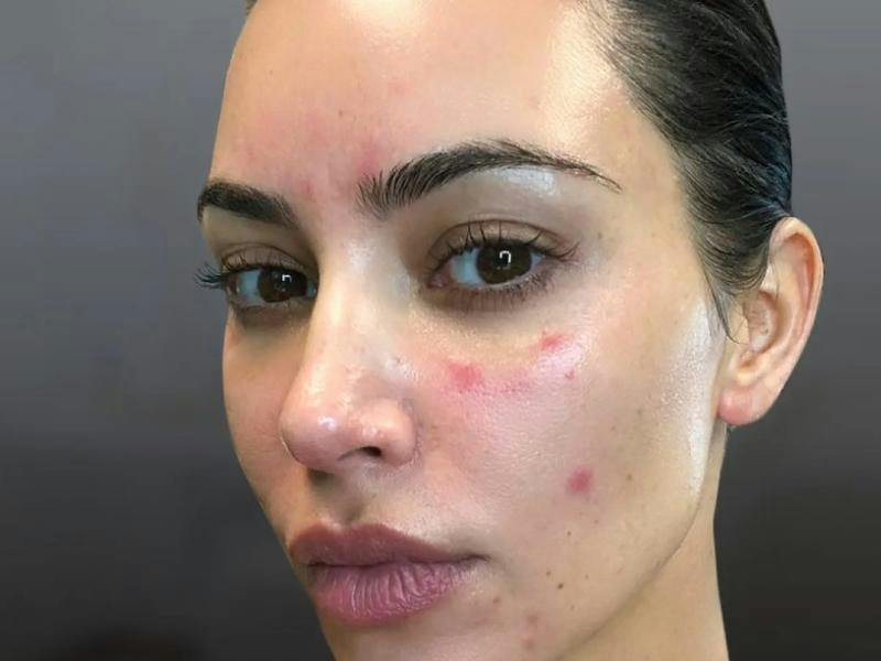 ¡Terror en el clan! Kim Kardashian acaba en el hospital y desata el pánico familiar ante un brutal diagnóstico: "¿Tu padre no murió de eso?"