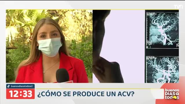 Hoy se conmemora el día mundial de previsión del ACV
