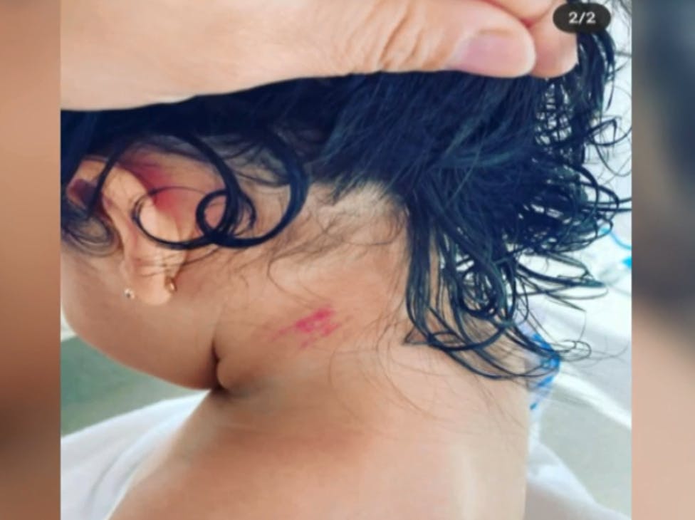 Madre denuncia malos tratos y golpes contra su hija de nueve meses en clínica 