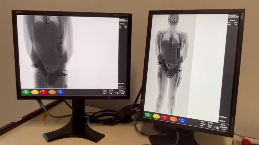Body Scan