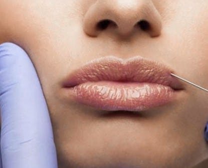¿En qué debo fijarme si quiero hacerme una cirugía estética?