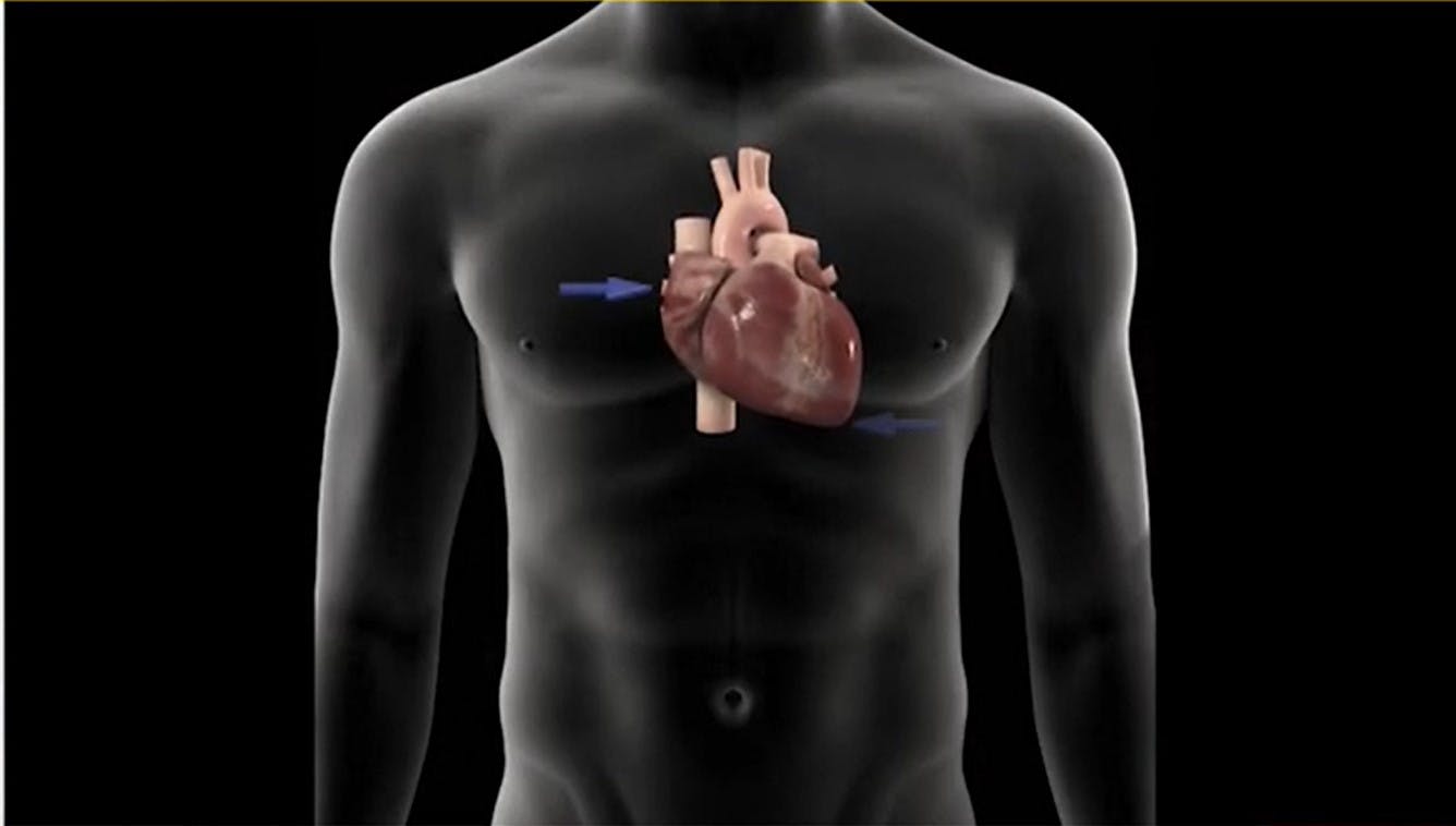 Hoy es el día mundial de la cardiopatía congénita