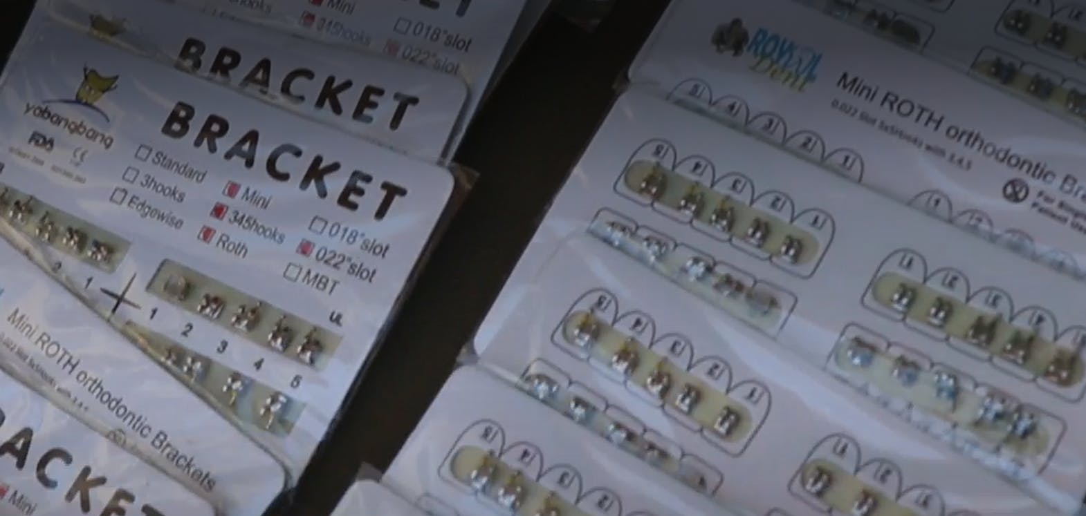 Brackets a 50 mil pesos: el peligro de las clínicas dentales clandestinas 
