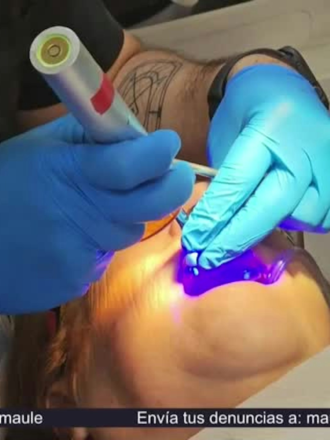Nuevo equipamiento para la rehabilitación oral del Hospital de Talca