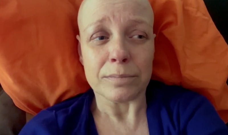 El desahogo de Claudia Conserva por su cáncer: Es una enfermedad muy complicada y triste