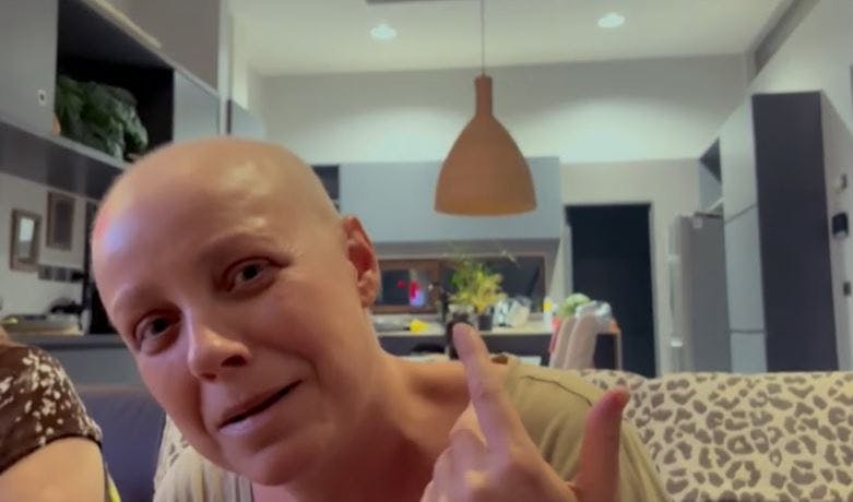 Le vuelve a crecer el pelo a Claudia Conserva