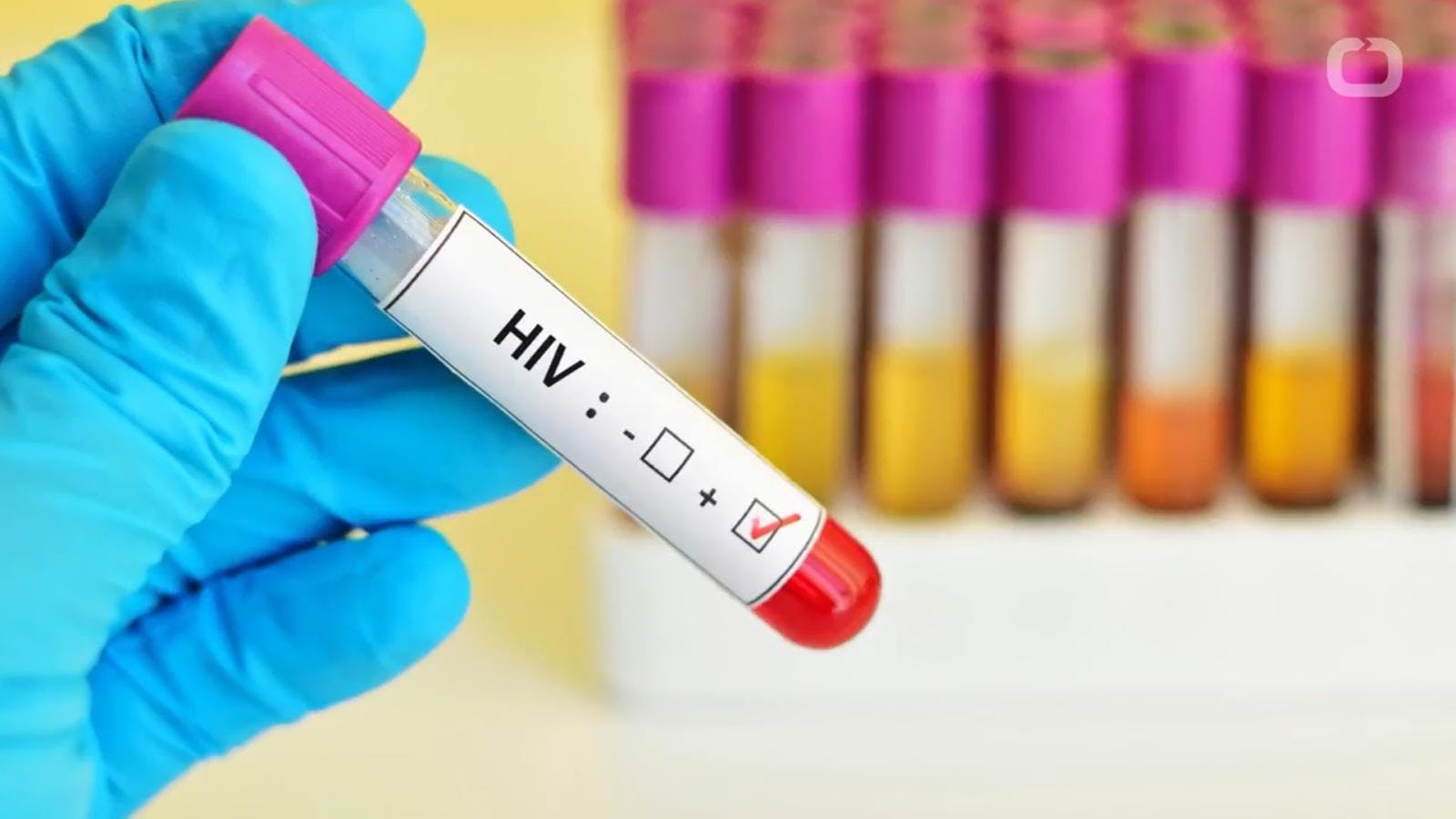 Aumentan casos de VIH en la región