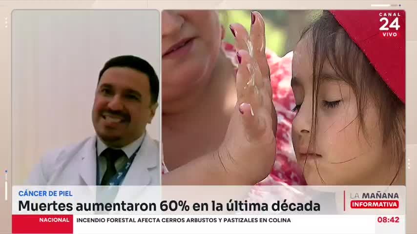 Médico por cáncer a la piel y verano: La prevención debiese ser siempre