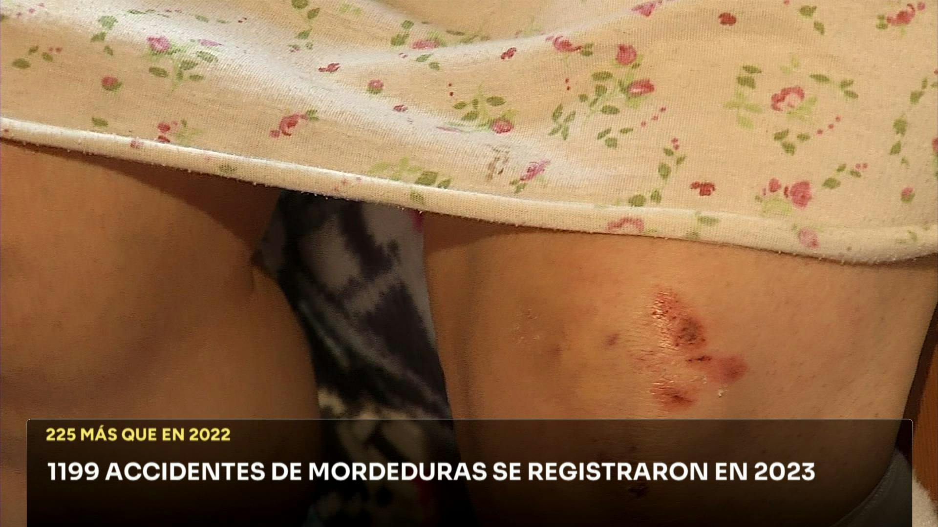 MORDEDURAS DE PERROS