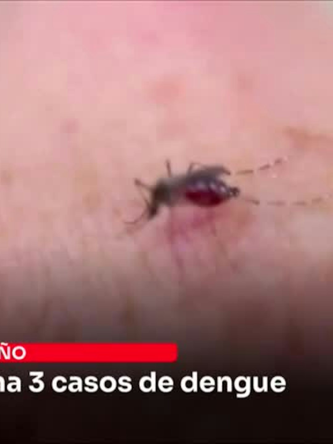 Salud confirma 3 casos de dengue