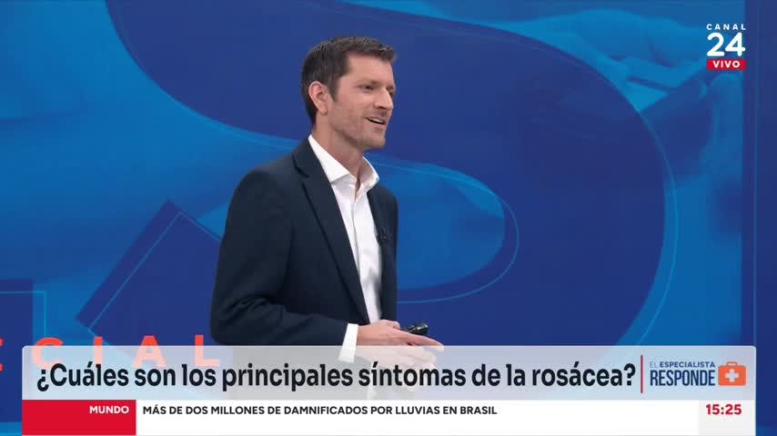 El Especialista responde: Cómo identificar los principales síntomas de la rosácea