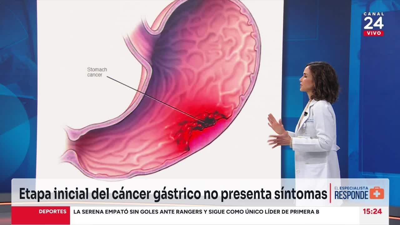 El Especialista responde: lo que debes saber sobre el cáncer gástrico