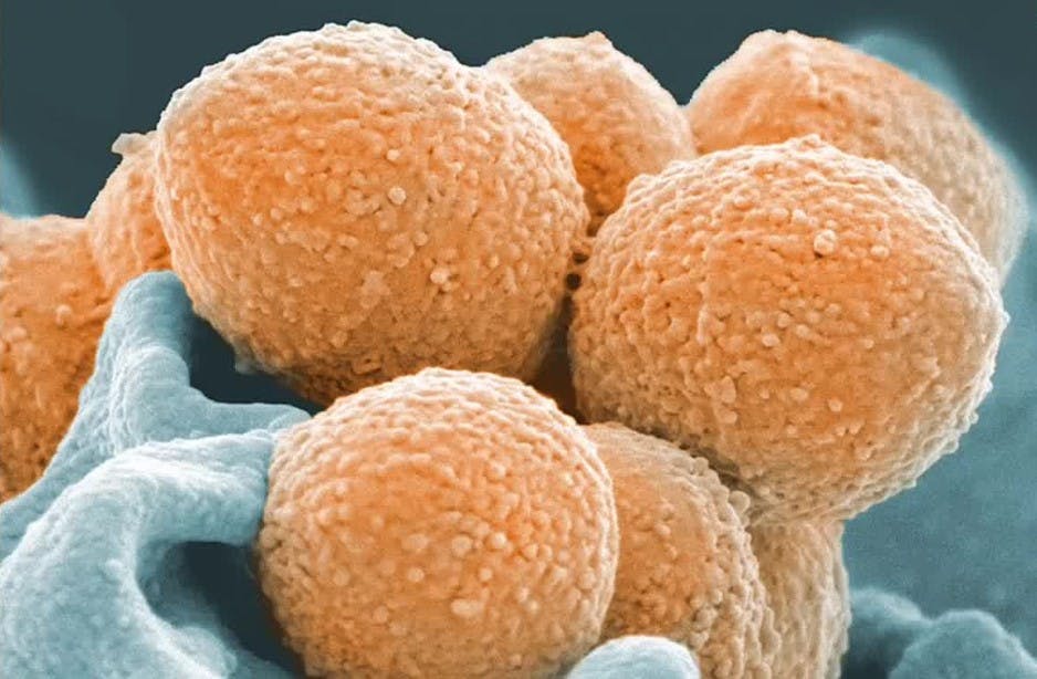 Streptococcus Pyogenes: ¿Qué es y por qué se le llama "bacteria asesina"?