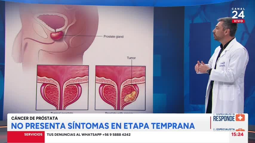 El Especialista responde: Lo que debes saber sobre el cáncer de próstata