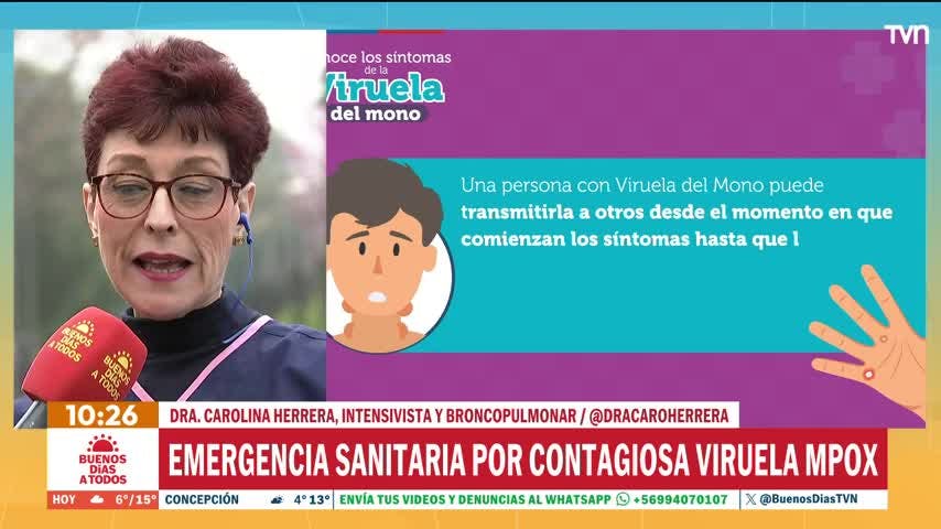 Alerta internacional por peligrosa "viruela del mono"
