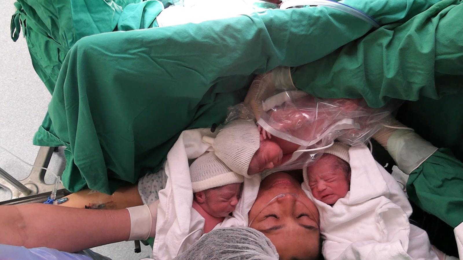 Inusual nacimiento de trillizos generales en Antofagasta