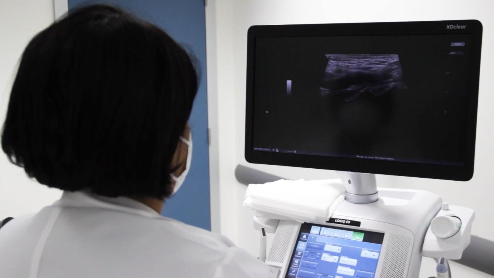 Realizan jornada de concientización del cáncer cérvico uterino 