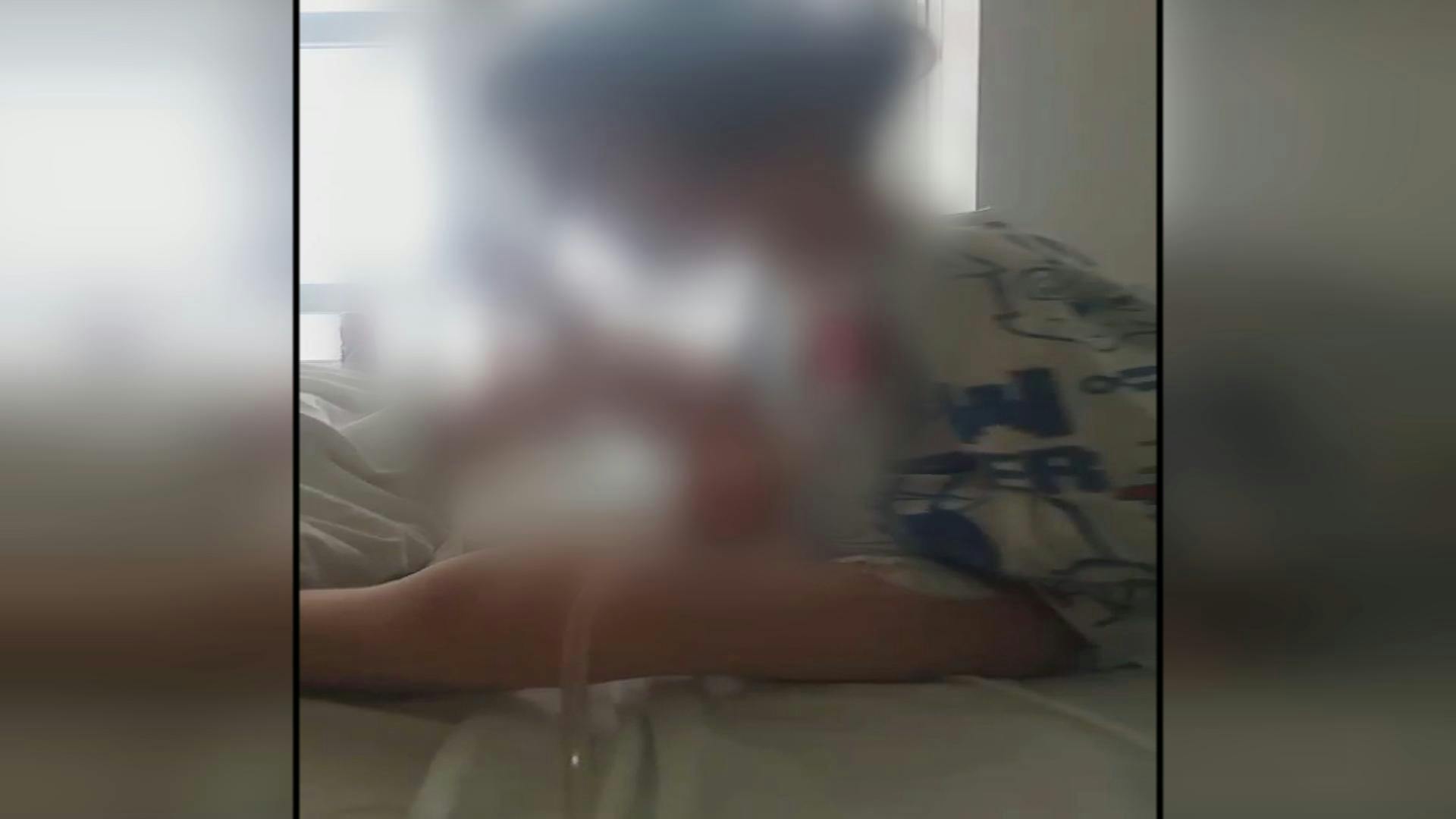 Denuncian que niño terminó con daño en su uretra