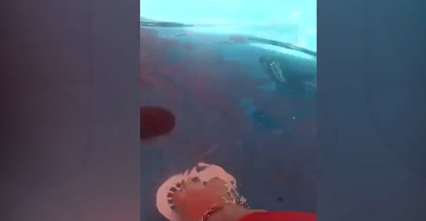 Lo sacaron porque se lo roban: Niña de tres años fue succionada por piscina sin tapón