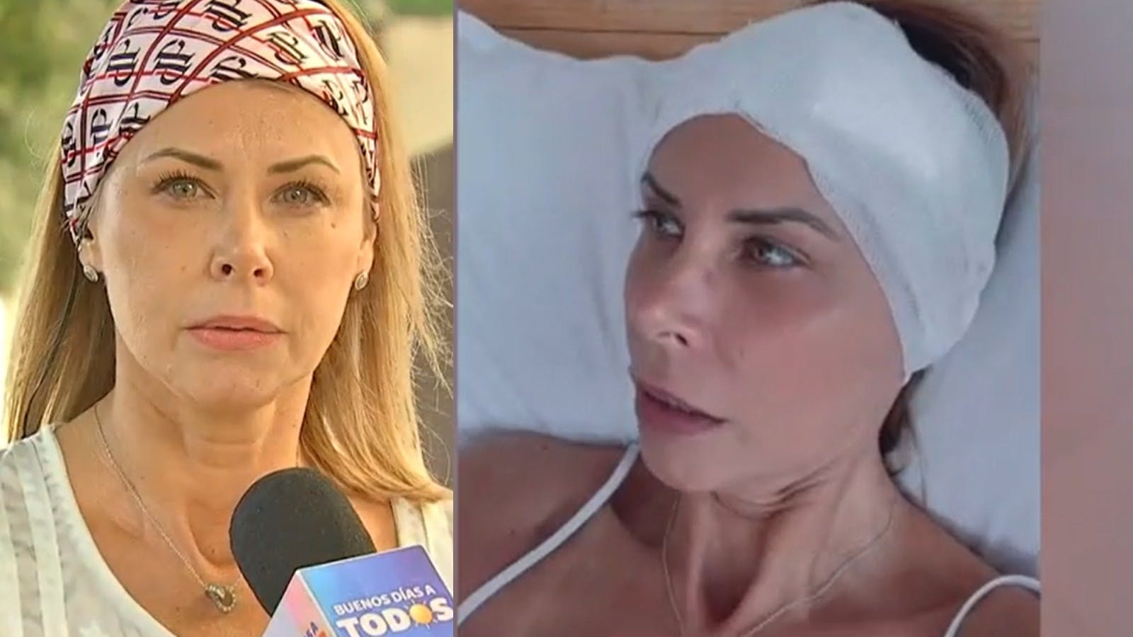 "No hicieron nada": Mariel Aereboe relata la serie de negligencias de hotel tras serio accidente en su cabeza 