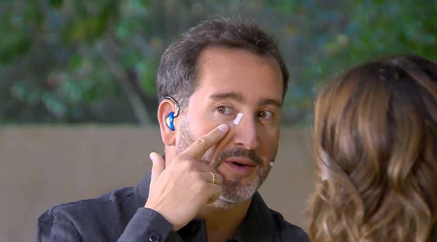 "Era malito...": Eduardo Fuentes explica la razón de su parche en su cara 
