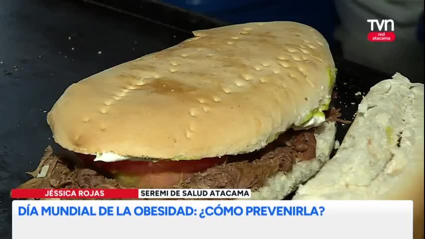 Día Mundial de la Obesidad