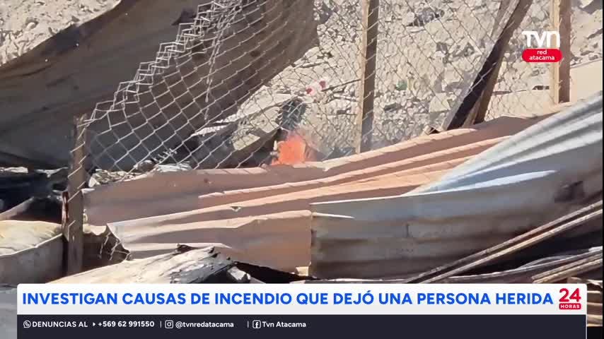 Incendio dejó una persona herida en Copiapó