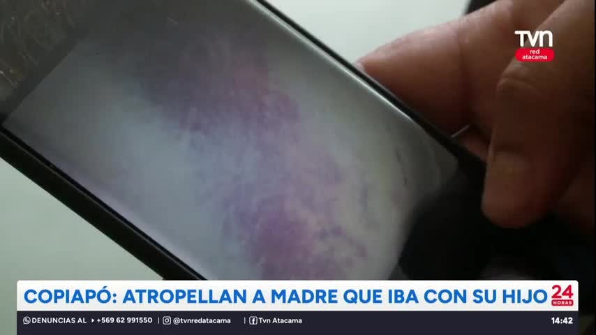 Copiapó: Atropellan a madre que iba con su hijo