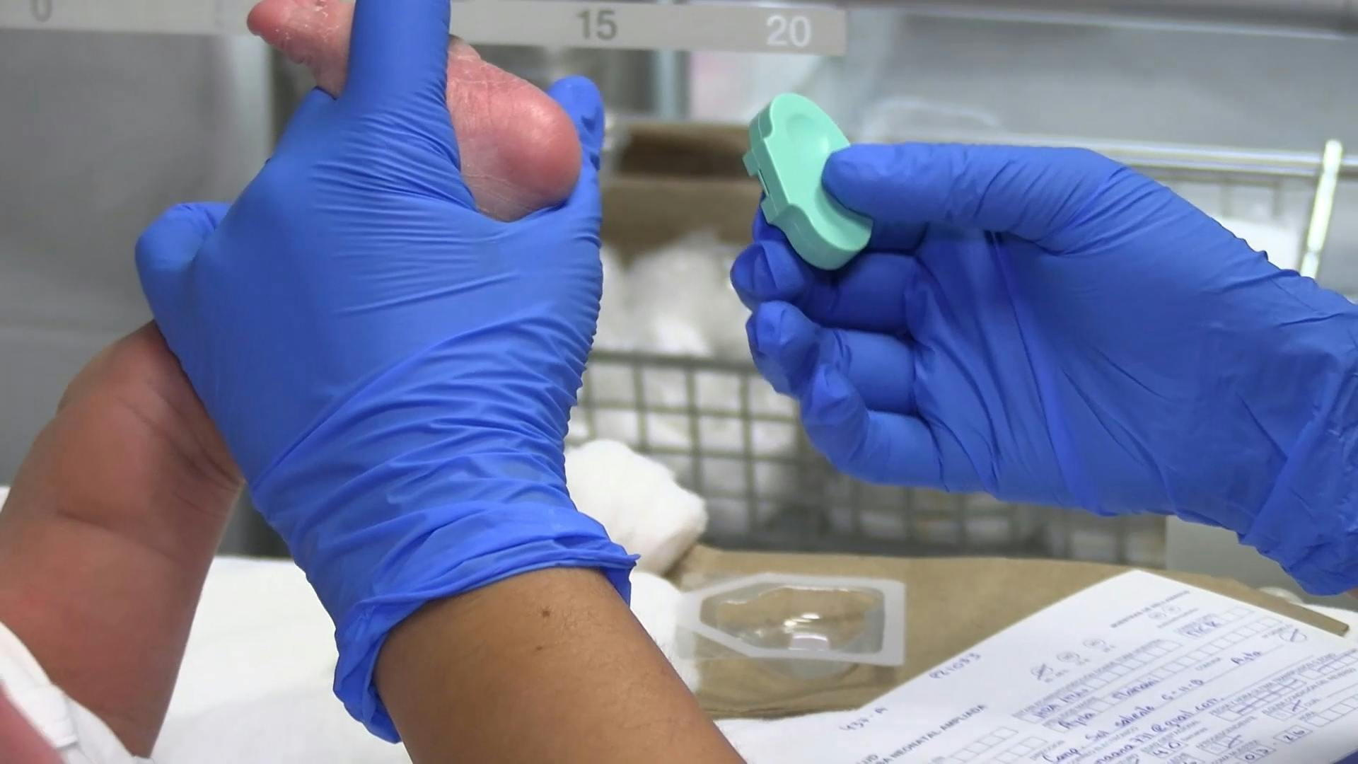 Hospital regional implementa pesquisa ampliada neonatal