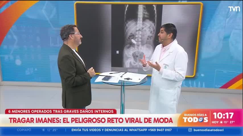 Ya van 6 menores de edad operados: Experto advierte los peligros del reto viral de tragar imanes