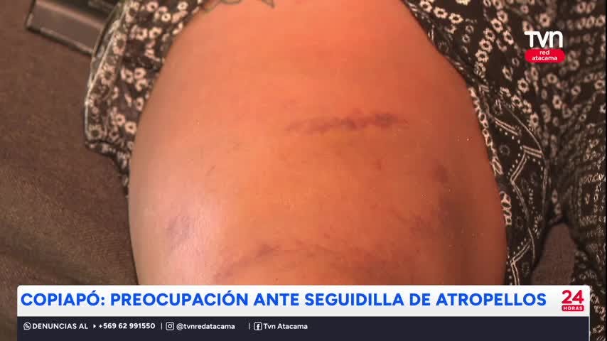 Copiapó: Preocupación por aumento de atropellos