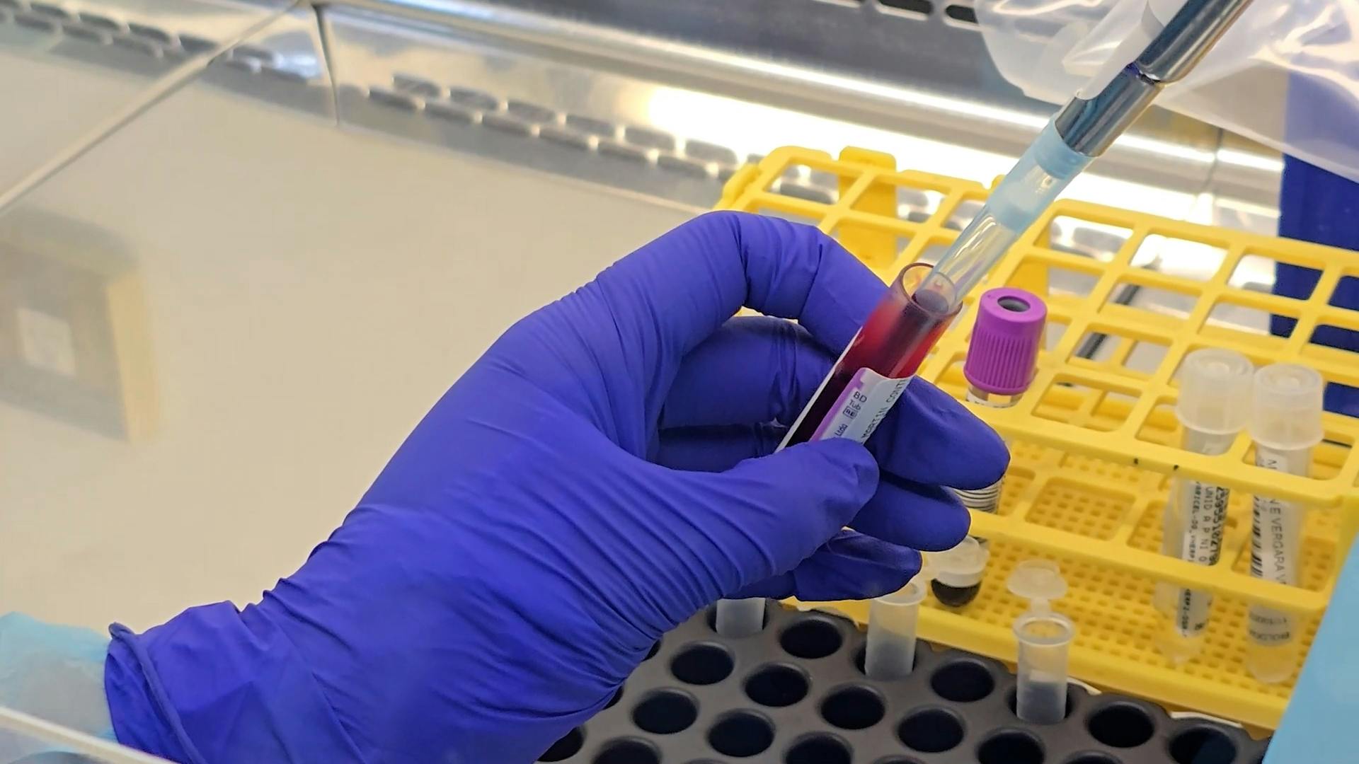 Hospital Regional pionero en farmacogenética en tratamientos de oncología y trasplantes