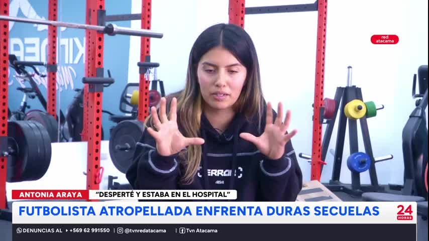 El accidente cambió la vida de jugadora de Deportes Copiapó