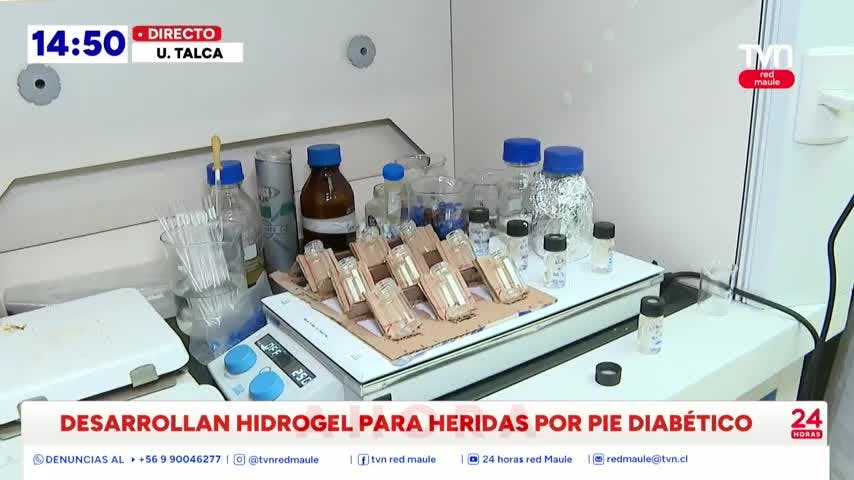 Crean Hidrogel que tiene propiedades curativos para lesiones por pie diabético