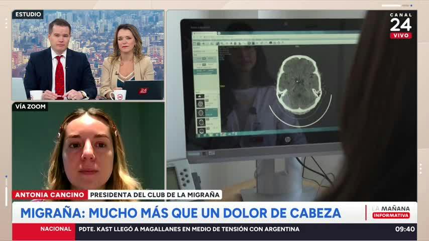 Más de 2,4 millones la sufre en Chile: causas, tratamientos y riesgos de la migraña