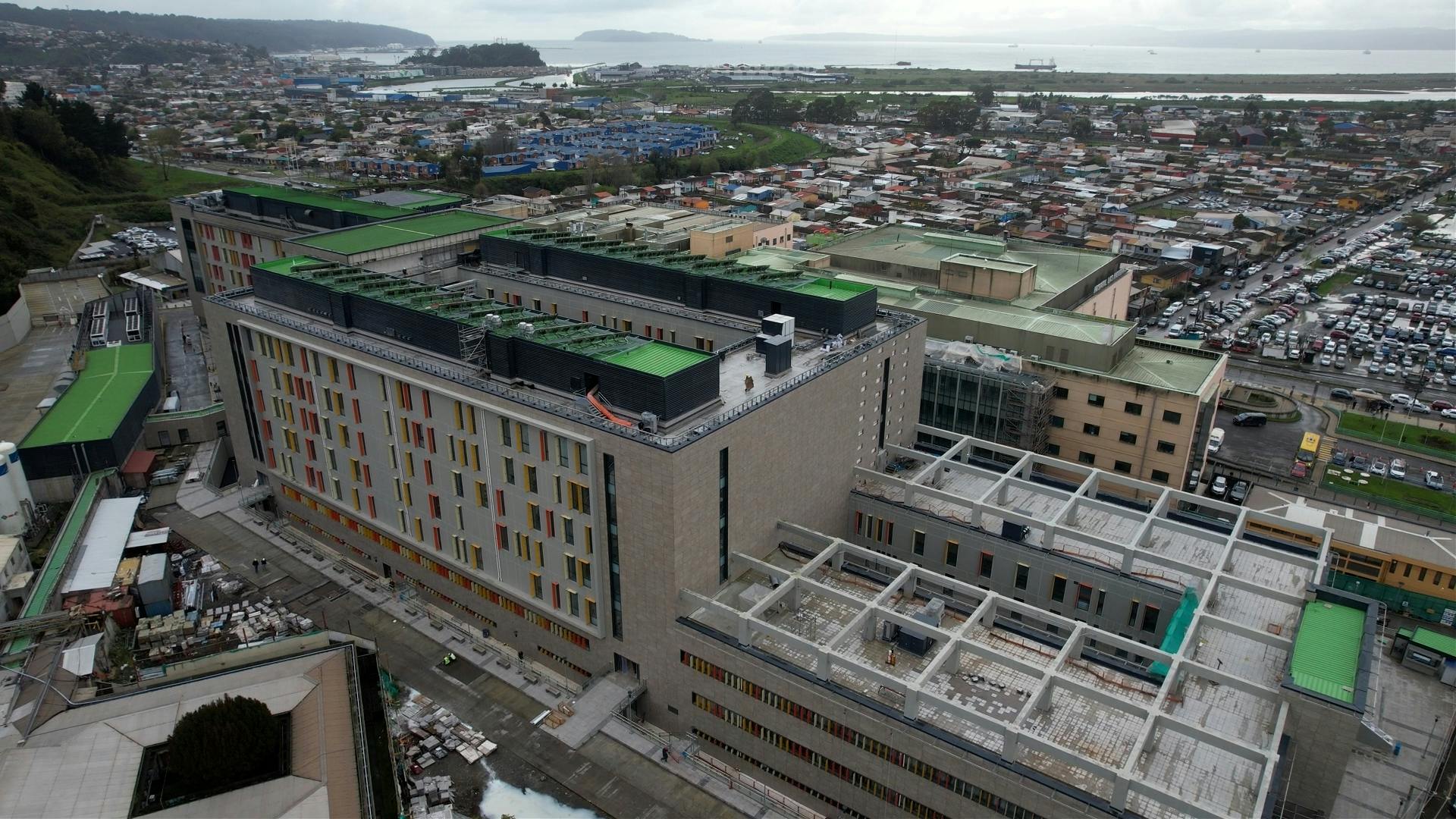 Hongos detecta Contraloría en obras de Hospital Las Higueras