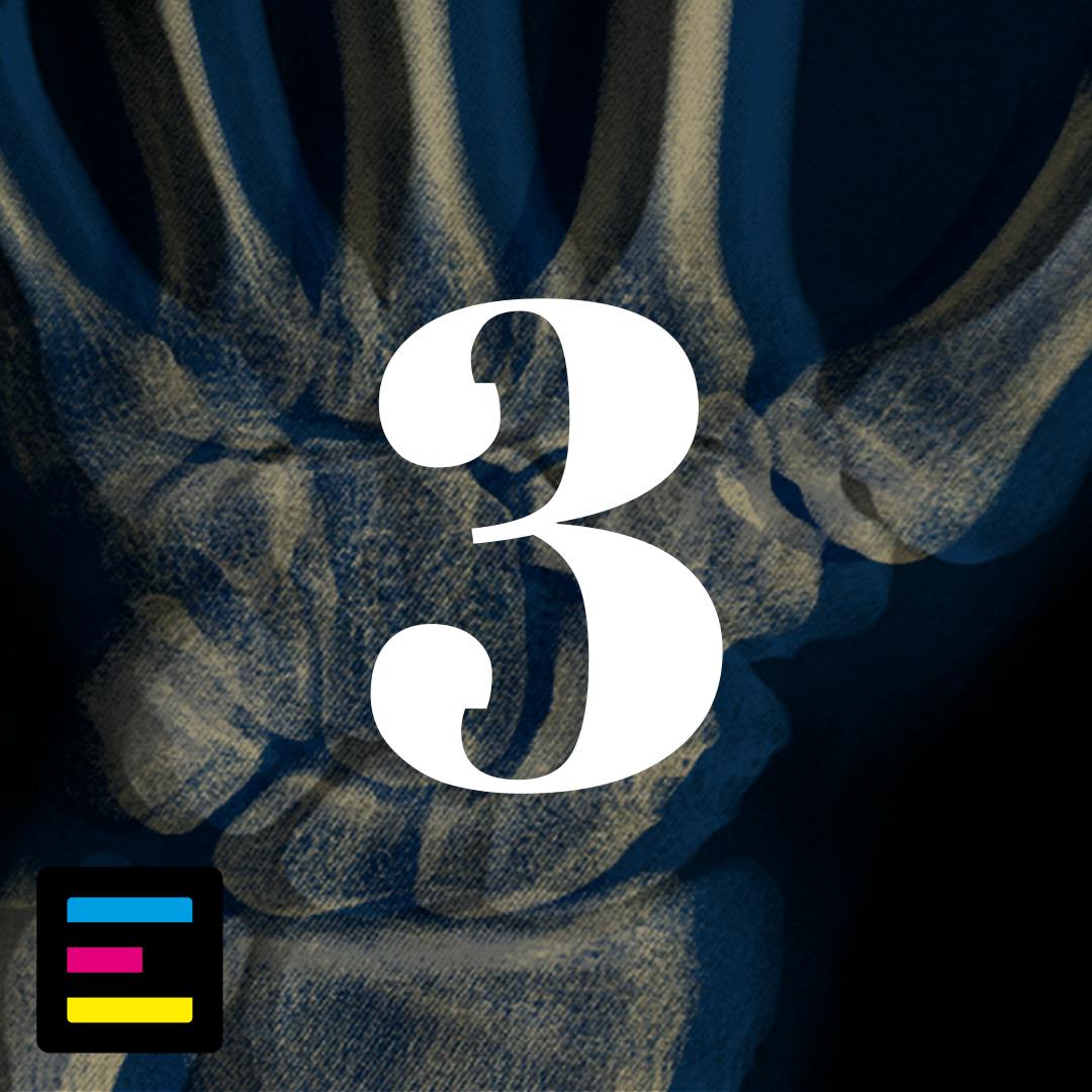 3