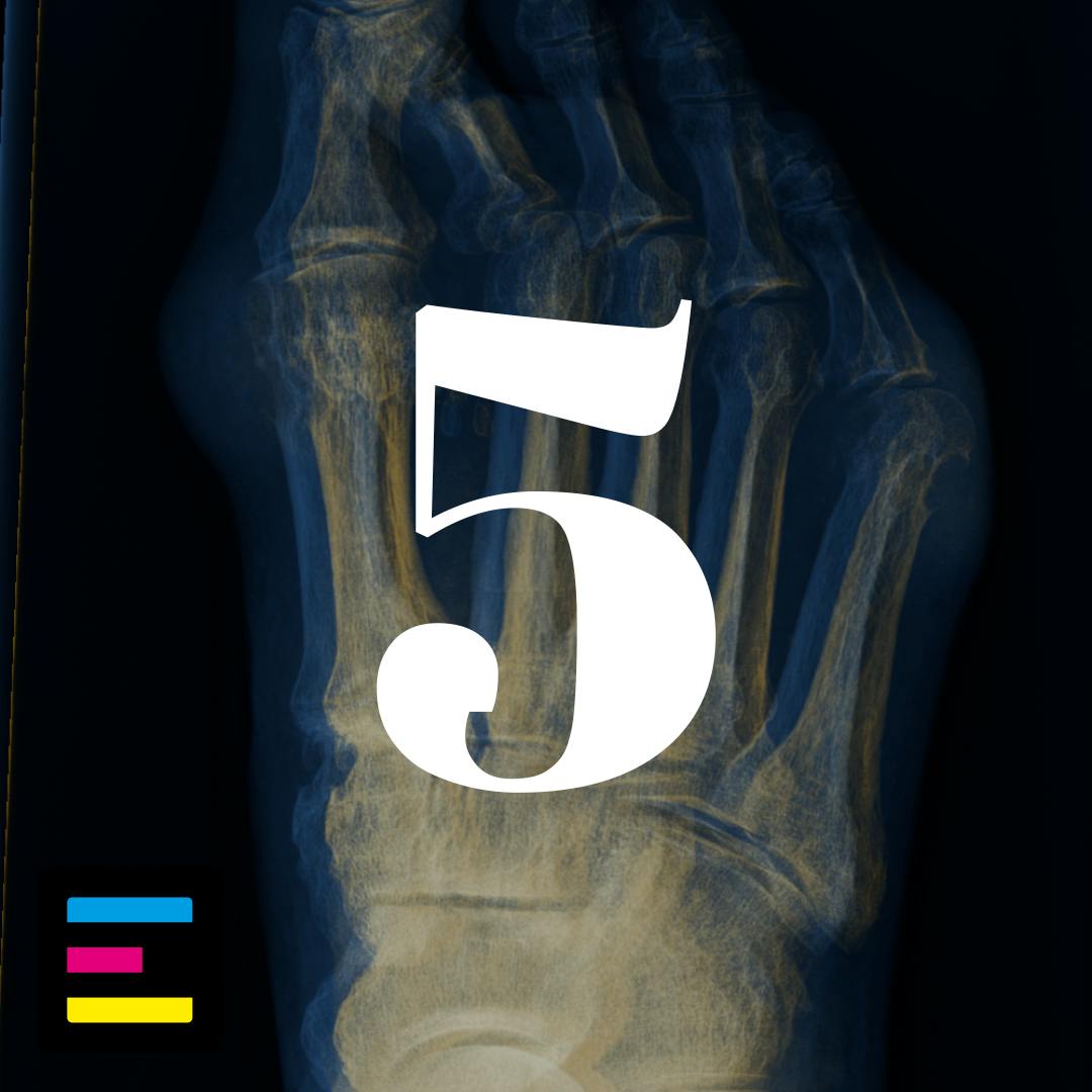 5