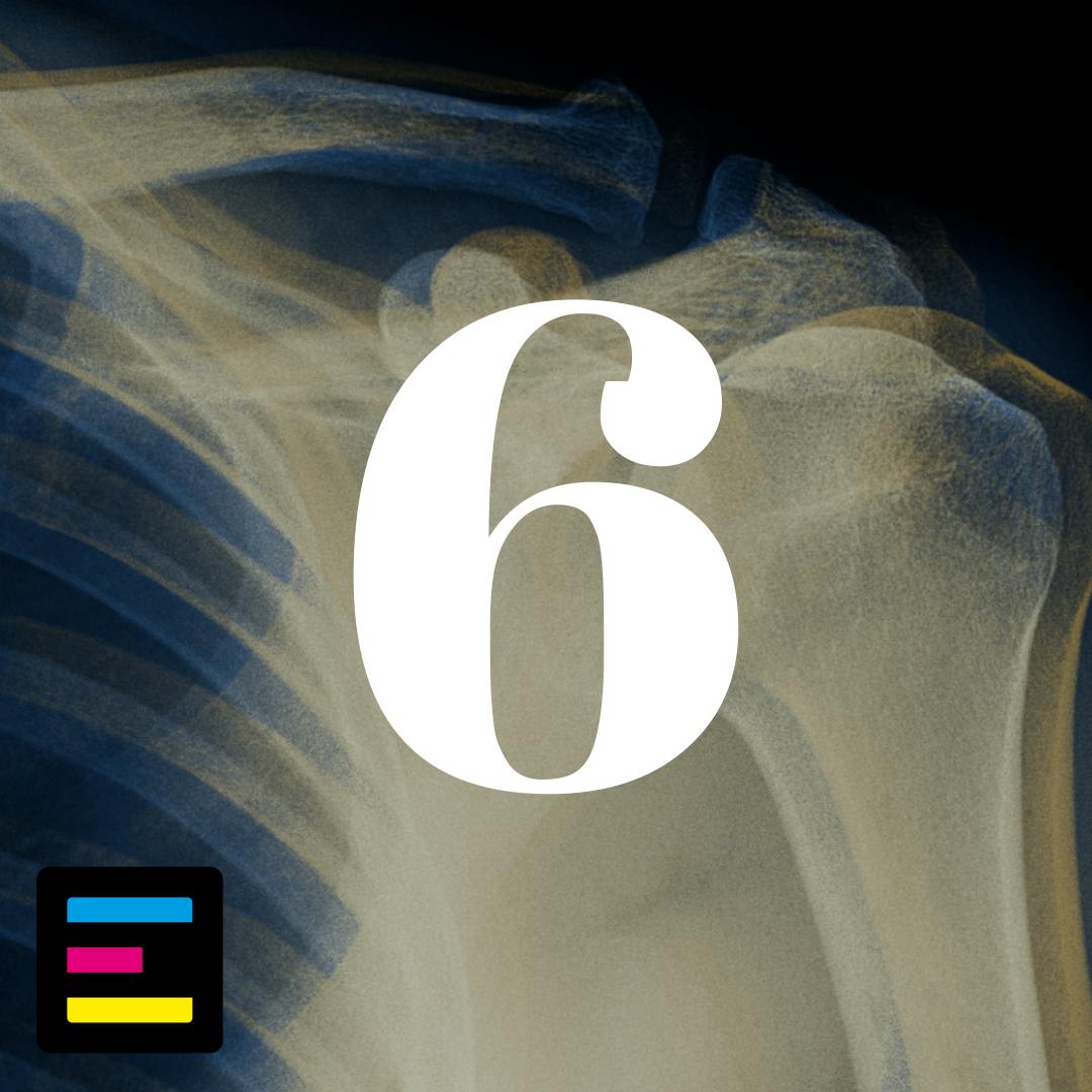 6