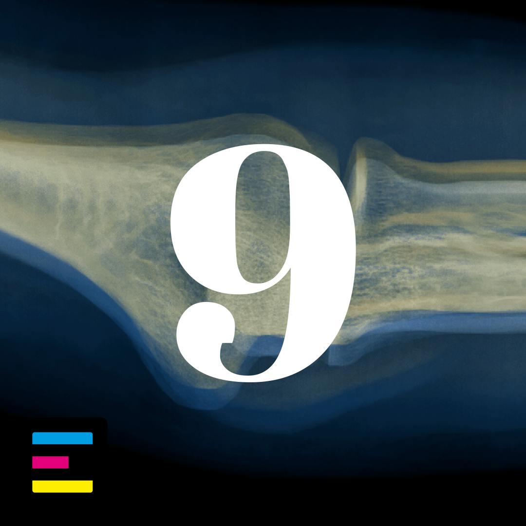9