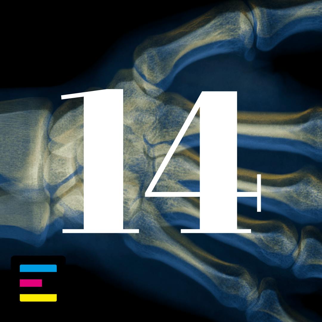 14