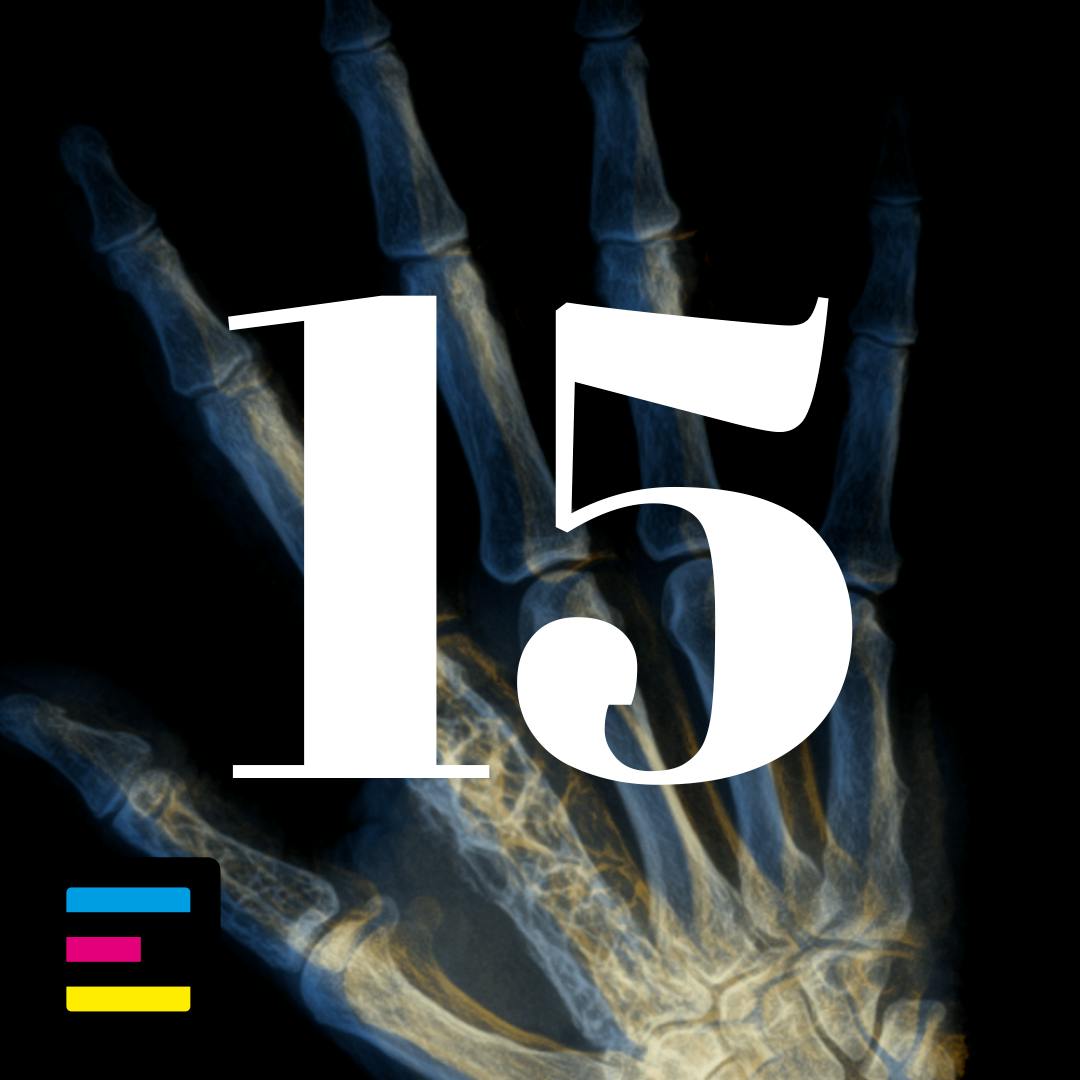 15